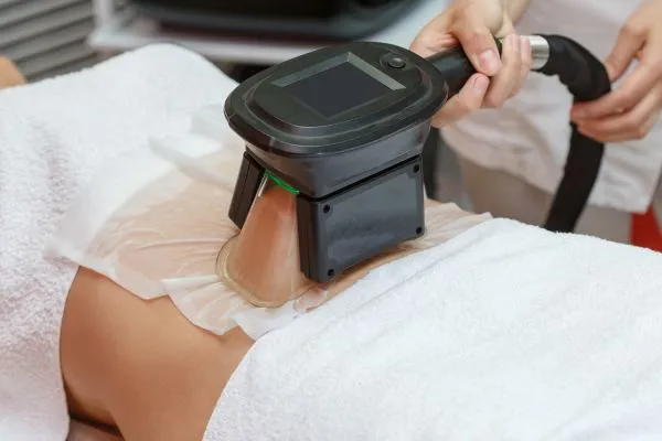 Image of person having fat freezing treatment to help weight gain Abingdon