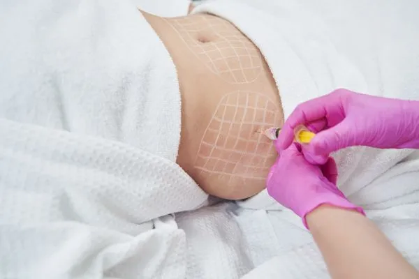 image of fat dissolving injections on love handles to help combat weight gain Abingdon