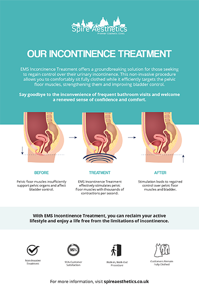 image to show how EMS treatment works for female urinary incontinence Abingdon