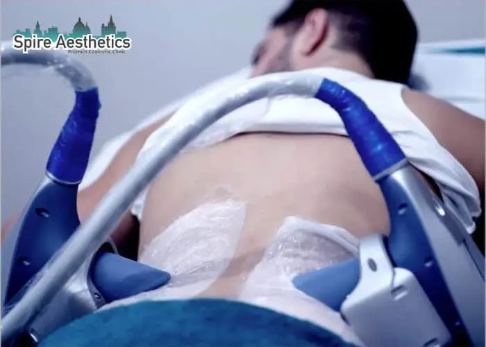 Man having fat freezing treatment done on love handles before a competitions Abingdon to create a sculpted look.