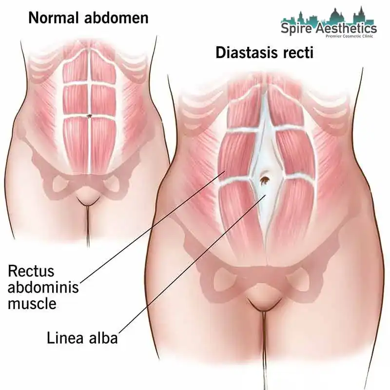 When Will My Belly Feel Normal Again Abingdon?