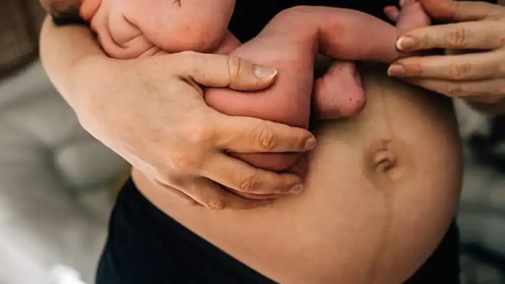 Why Is My Stomach Still Big After Pregnancy Abingdon?