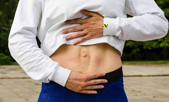 When Could Diastasis Recti Be the Missing Piece of the Puzzle Abingdon?